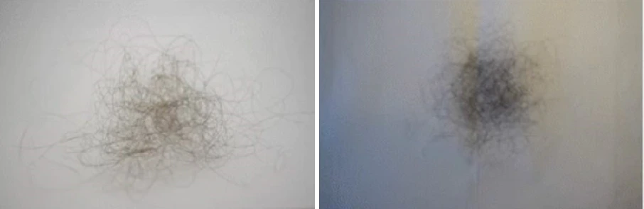 Photo showing 100 hairs from a person with short hair (left) and longer hair (right).