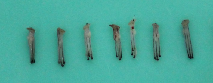 Close up photos of extracted grafts containing 3-4 hair follicles