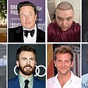 Celebrity Hair Transplants Before & After