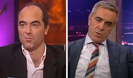James Nesbitt Hair Transplant