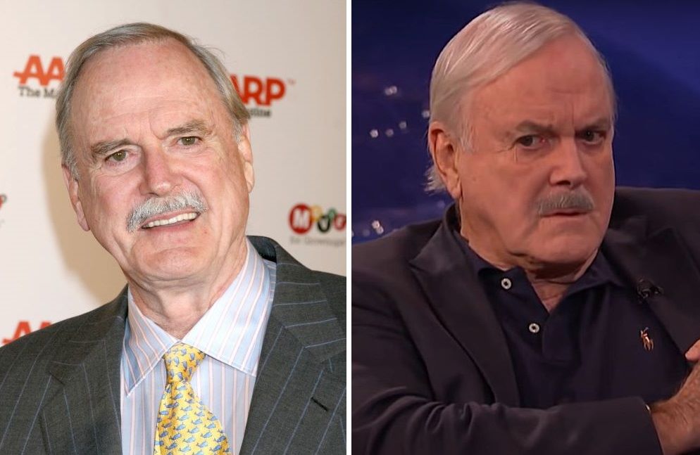 John Cleese hair transplant