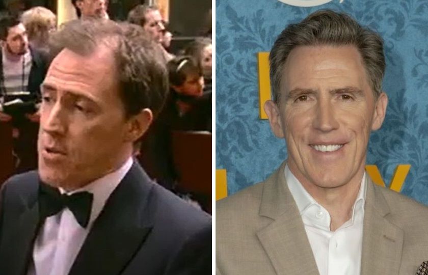 Rob Brydon hair transplant