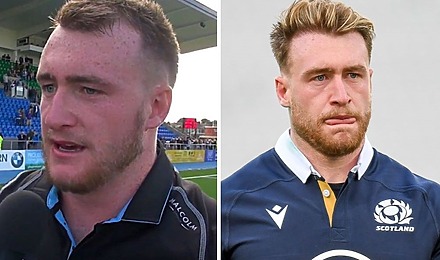 Stuart Hogg Hair Transplant