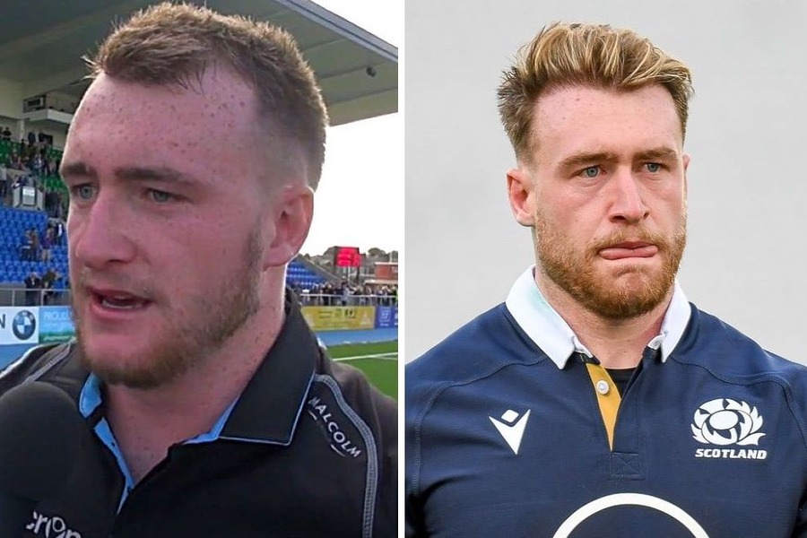 Stuart Hogg Hair Transplant