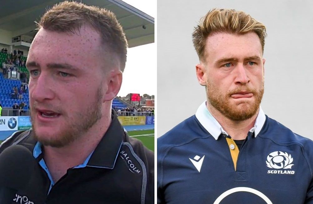 Stuart Hogg hair transplant