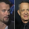 Tom Hanks’ Hair Transplant: Everything You Need To Know