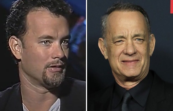 Tom Hanks hair transplant