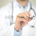Getting Ready For Hair Transplant Surgery: The Essential Steps