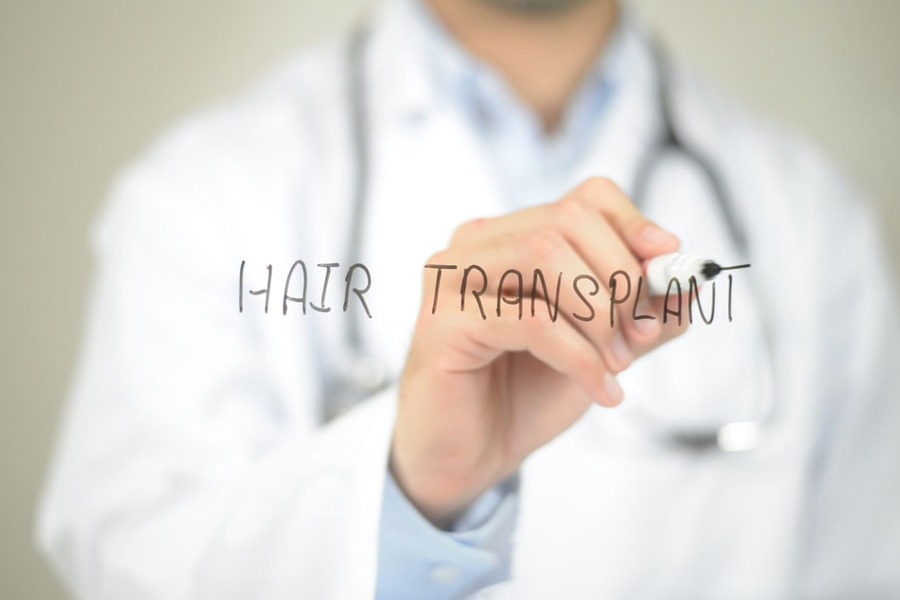 Getting Ready For Hair Transplant Surgery