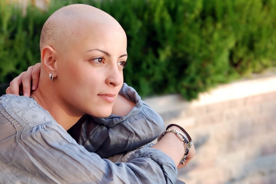 Chemotherapy Hair Loss