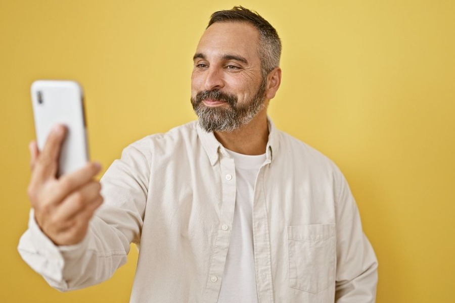 Do Beard Transplants Look Natural