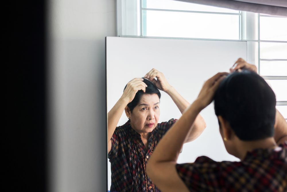 How does hair loss occur in Asian women?