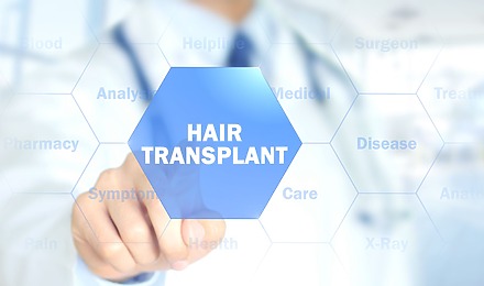 Hair Transplant Candidate