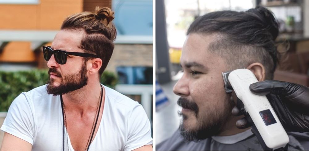 Men with man buns and temple hair loss