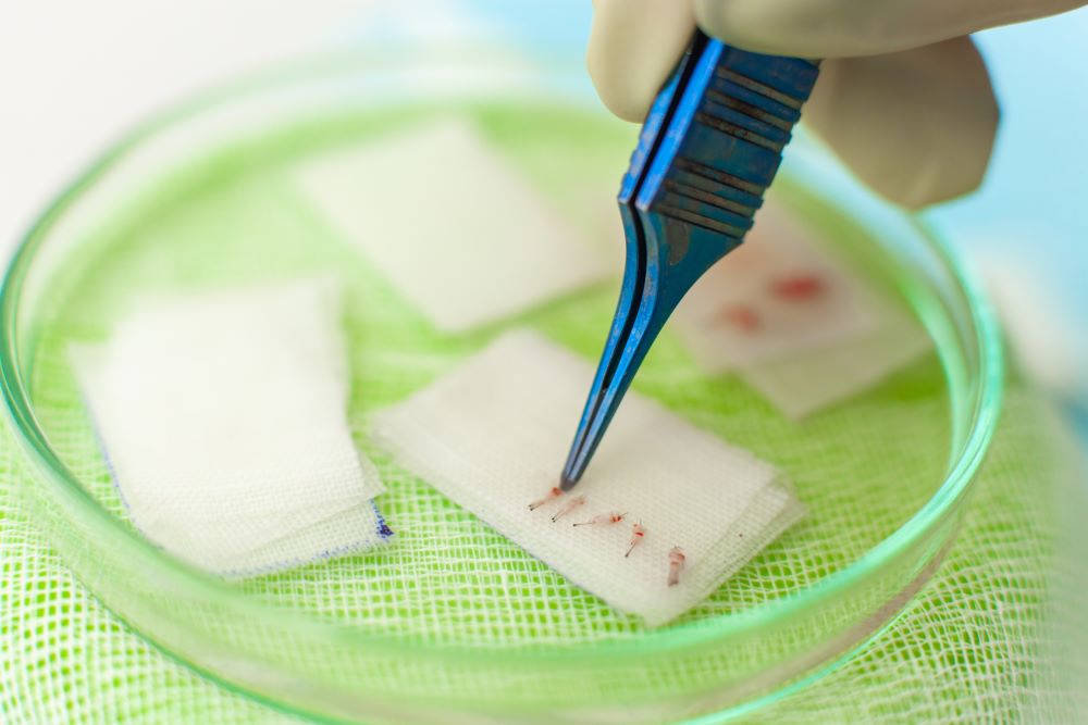 Close up image of extracted hair grafts