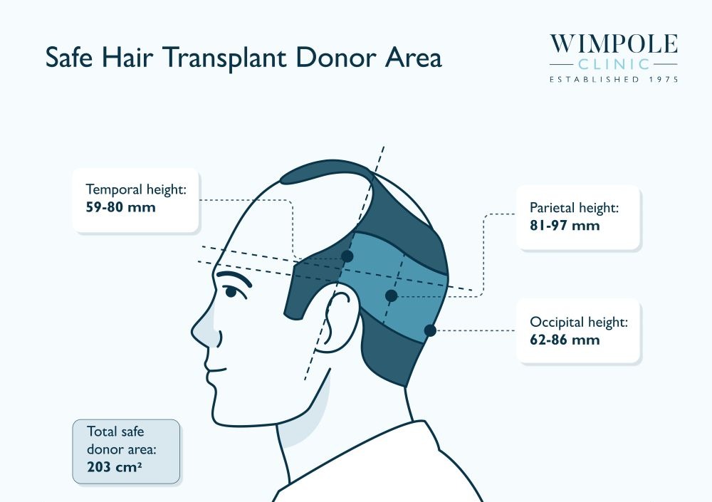 Safe Hair Transplant Donor Area (2)