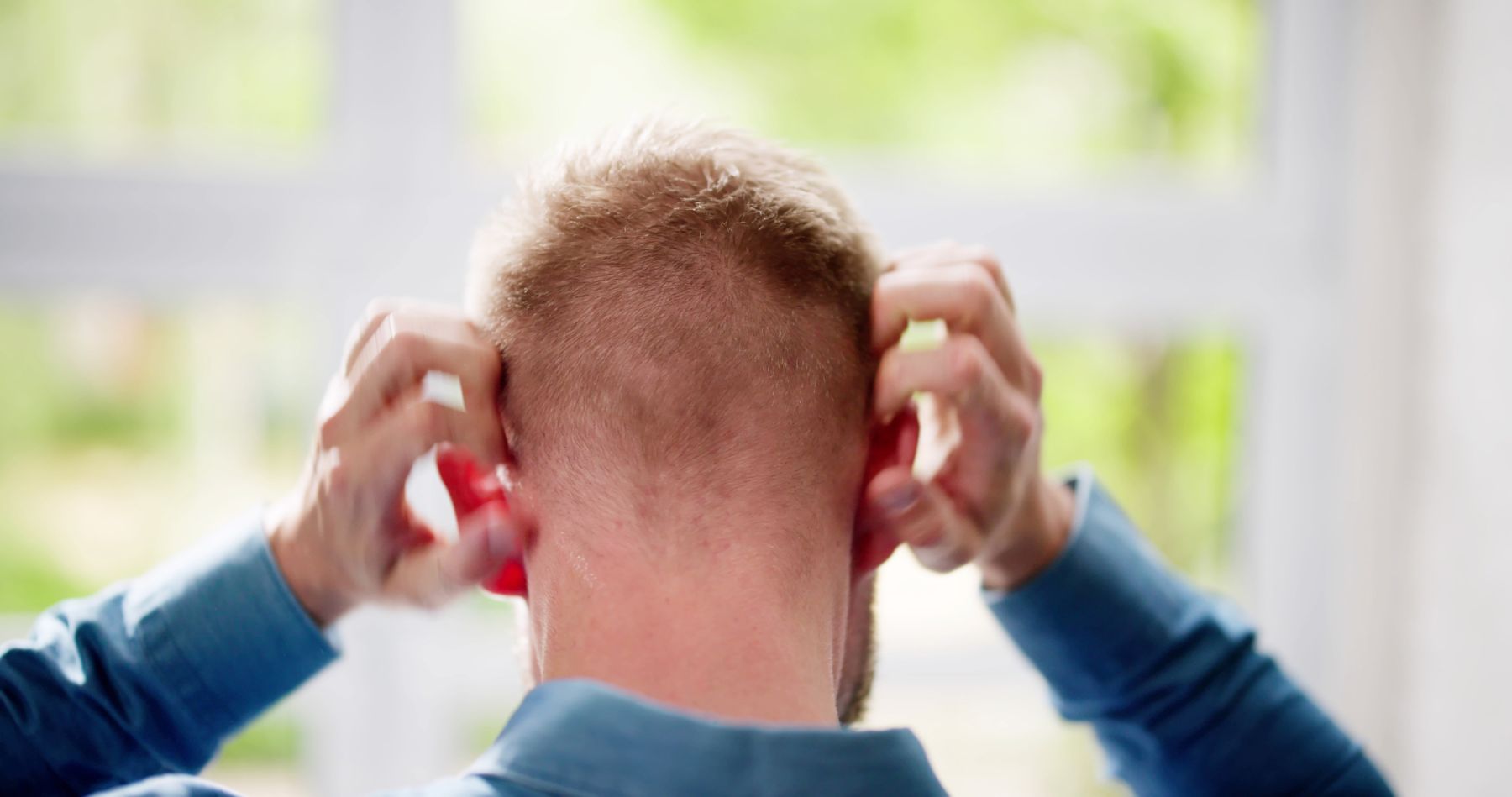 Man with itching as a hair transplant side effect