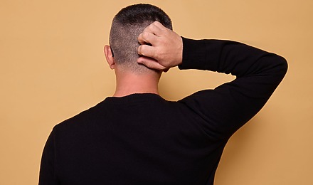 Hair Transplant Side Effects