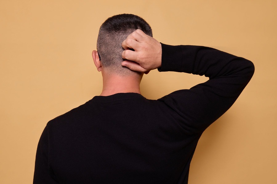 Hair Transplant Side Effects