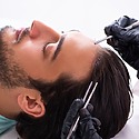 Hair Plugs Vs Hair Transplant: What’s The Difference?