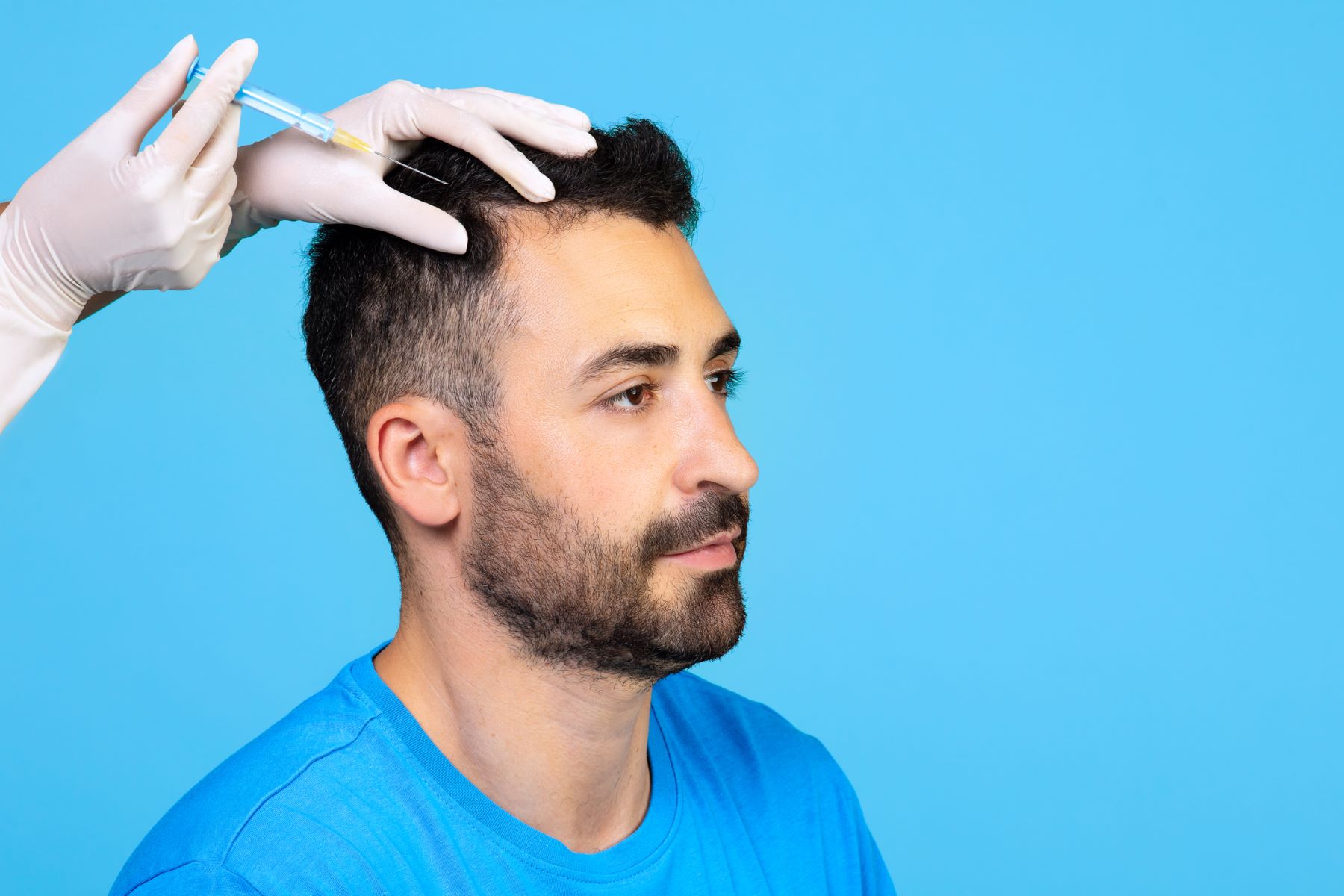 man getting treatment for receding hairline