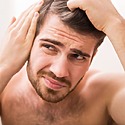 Uneven Hairlines: Causes, Symptoms & How To Fix It