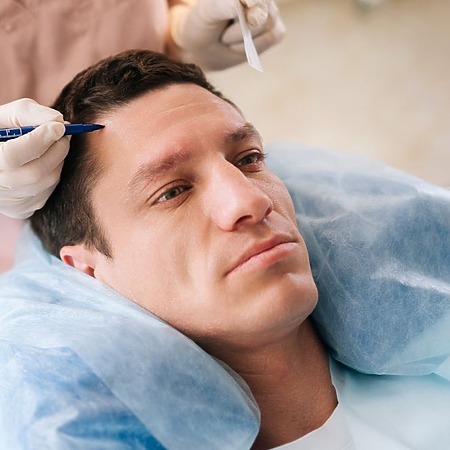 does hair transplant hurt