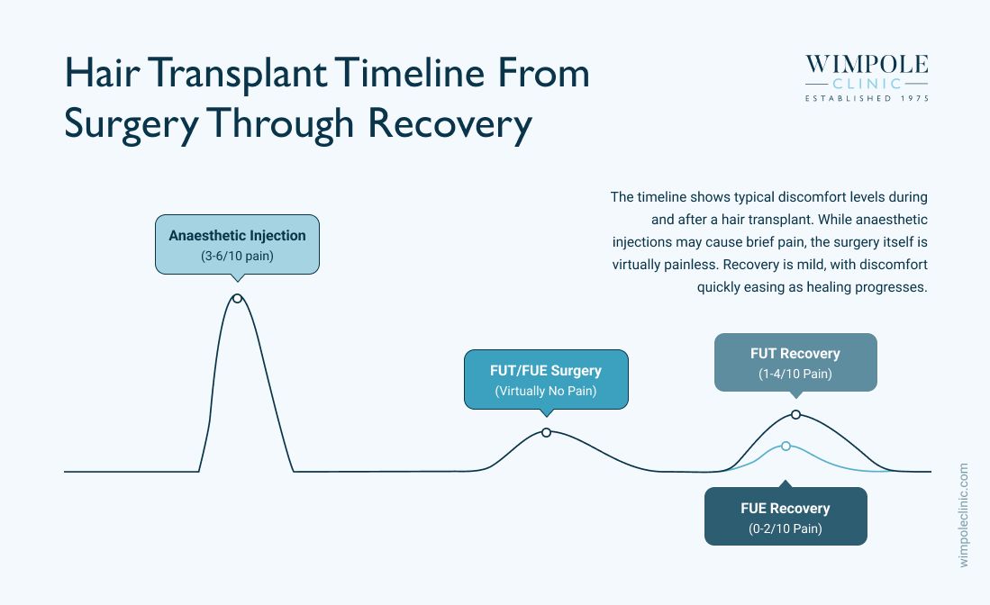 hair transplant timeline from surgery through recovery