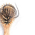 4 Reasons Why You Might Be Losing Your Hair