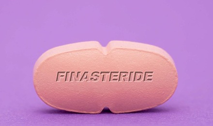 Finasteride Guide