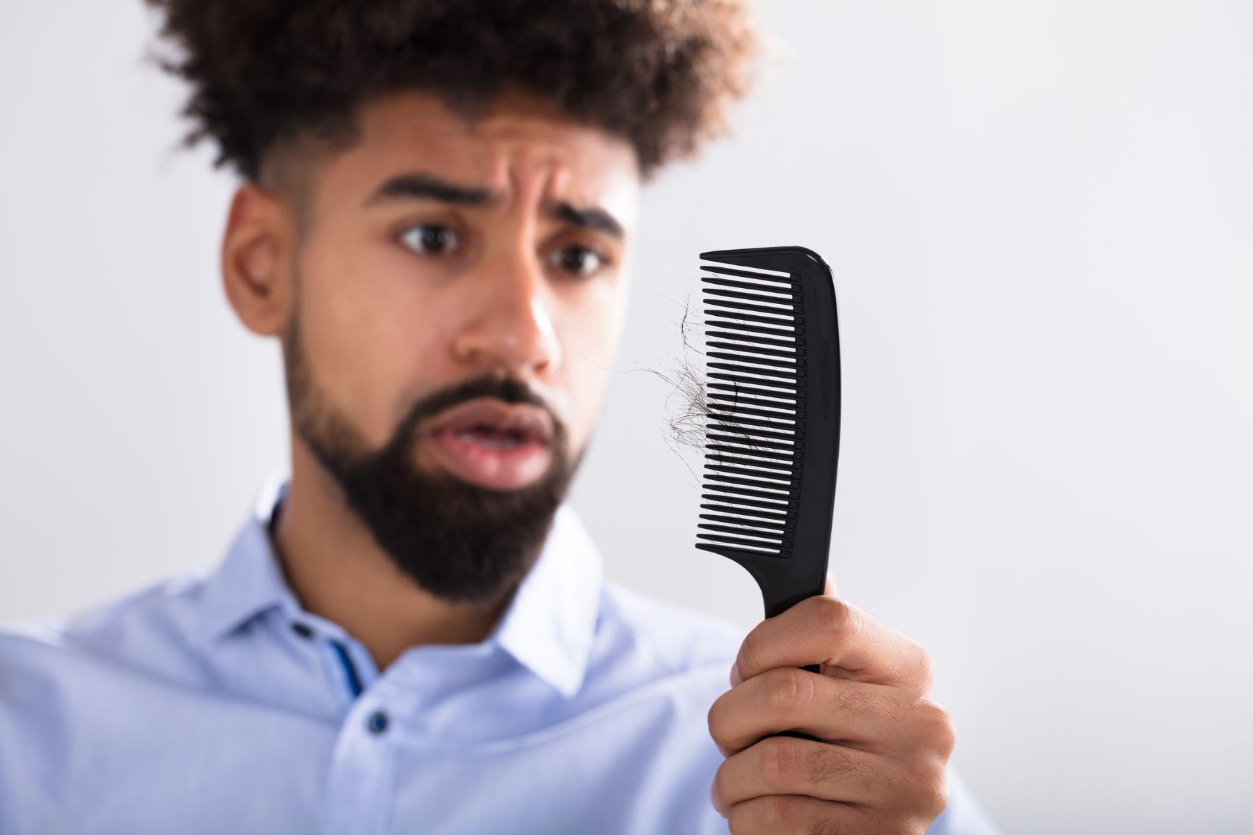 Man worried about losing hair