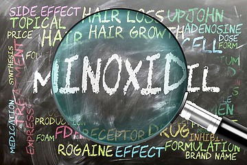 Minoxidil Hair Loss