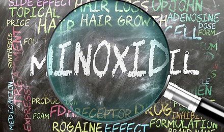 Minoxidil Hair Loss