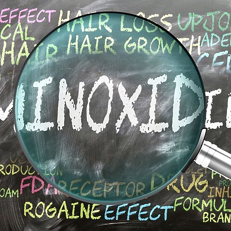 Minoxidil Hair Loss