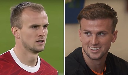 Rob Holding Hair Transplant