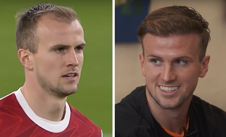 Rob Holding Hair Transplant