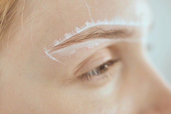 eyebrow hair loss