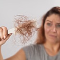 Telogen Effluvium: Symptoms, Causes & Treatment Options