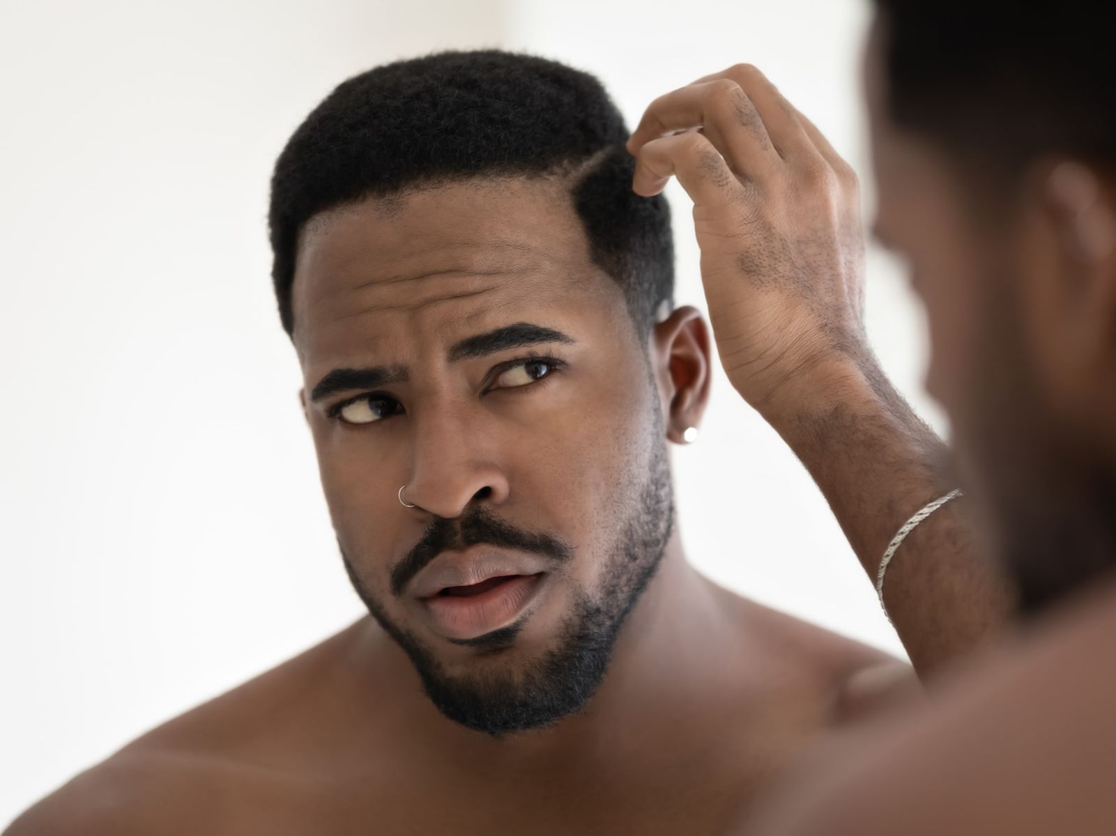 Do hair transplants work better than other hair restoration methods?