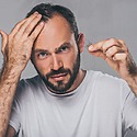 Androgenetic Alopecia: Causes, Diagnosis & Treatment