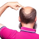 How Many Hair Transplants Can You Have?