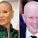 12 Celebrities With Alopecia: Dealing With Hair Loss