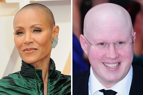 12 Celebrities With Alopecia: Dealing With Hair Loss