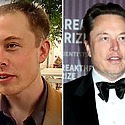 Elon Musk Hair Transplant: Everything You Need To Know
