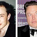 Elon Musk Hair Transplant: Everything You Need To Know