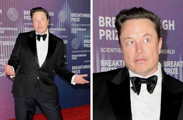 Elon Musk Hair Transplant: Everything You Need To Know