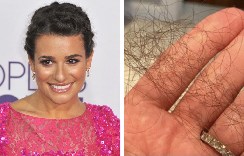 Lea Michelle hair loss