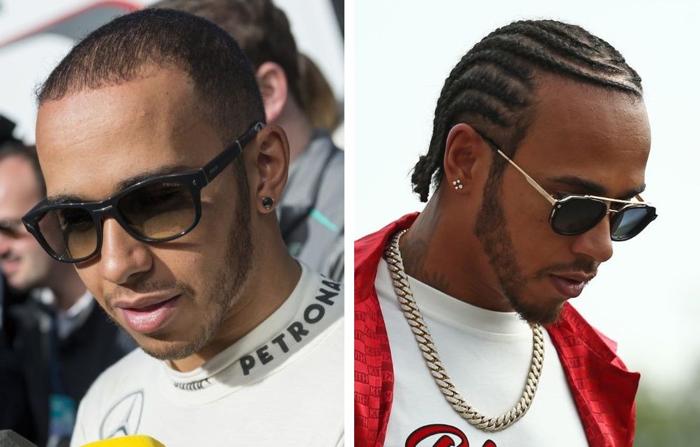 Lewis Hamilton before and after possible hair transplant