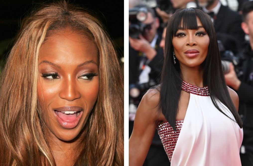 Naomi Campbell hair loss