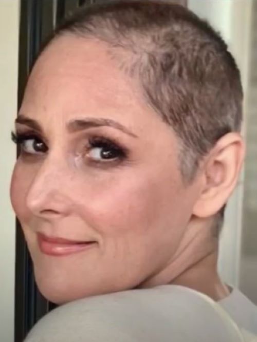 Ricki Lake hair loss